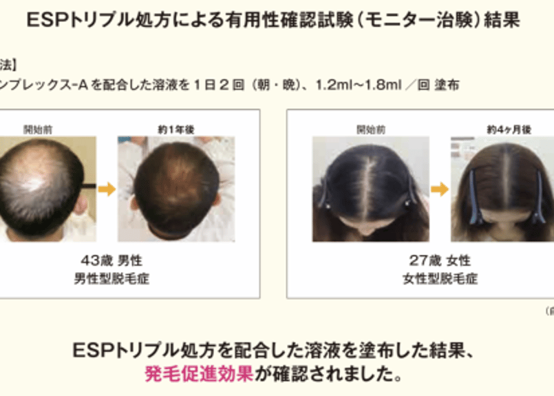 育毛促進期 育毛用ヘアエッセンス◇ゼウスゼロトゥワン◇ZeUS「0 to 1」 薄毛