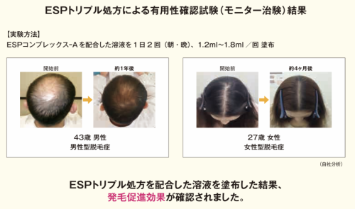 育毛用ヘアエッセンス◇ゼウスゼロトゥワン◇ZeUS「0 to 1」 薄毛