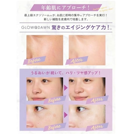 ✅在庫限り✅GLOW＠DAWN 1st エクソソーム　導入美容液