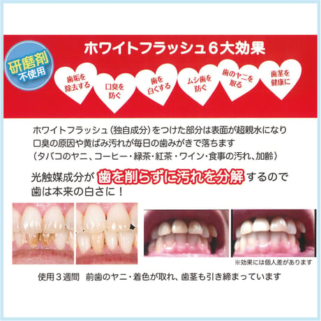 ホワイトフラッシュ 95g×2本ｾｯﾄ