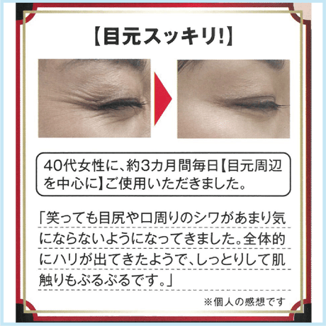 セラムリッチ アルジレリン原液 30ml