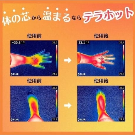 テラホット・ふくらはぎサポーター】テラヘルツ遠赤外線を発生する血行促進サポーター