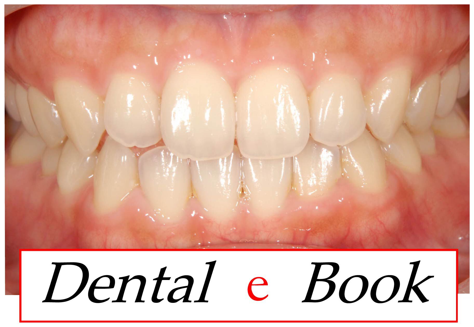 Dental e Book
