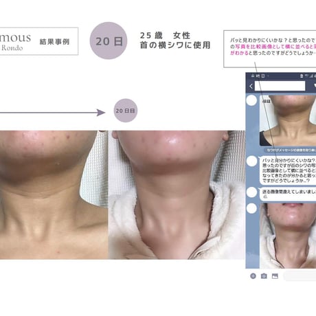 [セインムー・ボーテロンド 100mL]  部分太り®美容液-顔・首のシワ改善/バストケア