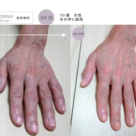 [セインムー・ボーテロンド 100mL]  部分太り®美容液-顔・首のシワ改善/バストケア