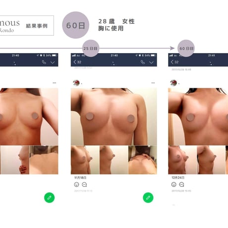 [セインムー・ボーテロンド 100mL]  部分太り®美容液-顔・首のシワ改善/バストケア