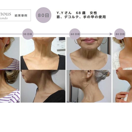 [セインムー・ボーテロンド 100mL]  部分太り®美容液-顔・首のシワ改善/バストケア