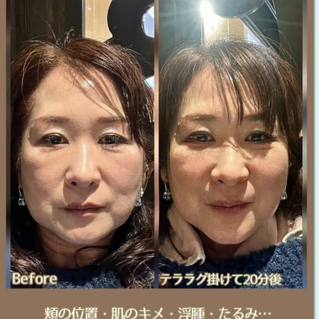 【予約販売】テラヘルツ波転写マット♡テララグTERALUXU特別価格《 発送は11月上旬 》