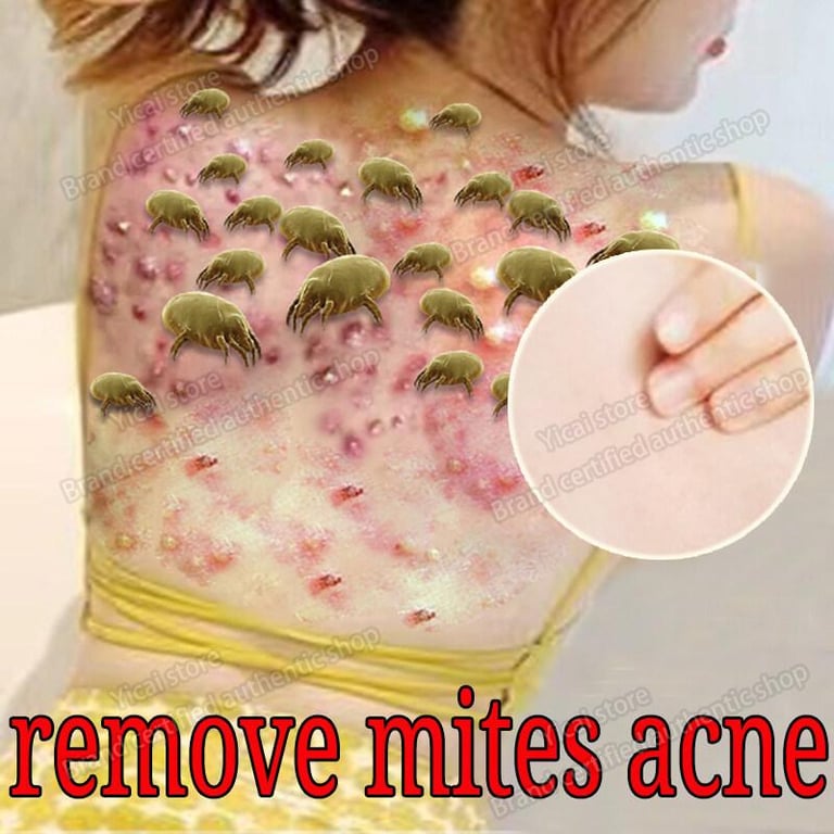 Wash Face Soap Mites Removal Body Shampoo Anti mite Soap Cleansing  Acne Treatment Shrink Pores Soap Whitening Blackhead Removal Face Wash Health Care Moisturizing For Men Women