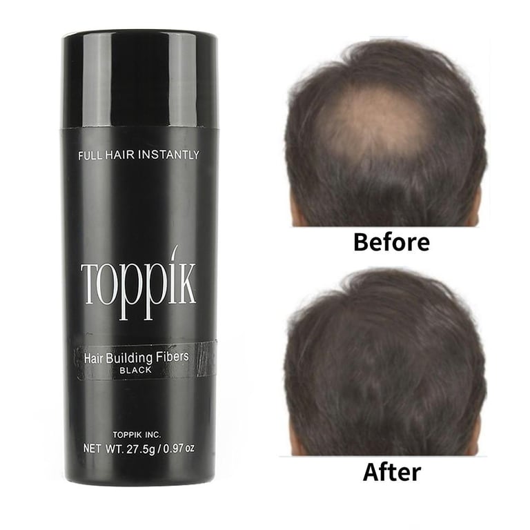 Favogue Hair Fibers Hair Loss Building Fibers+Applicator Spray&Hairline Optimizer 27.5g(Covers Bald Spots Promotes Hair Growth Hair Loss Conceal)