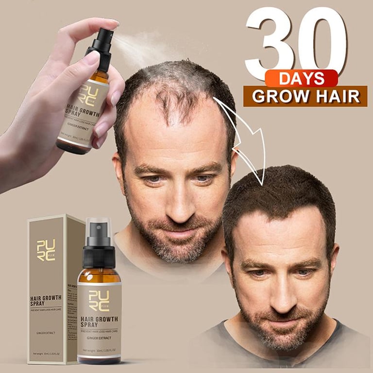 |CPZ| PURC New Hair Growth Spray Fast Grow Hair Oil Hair Loss Treatment HairCare 20ml