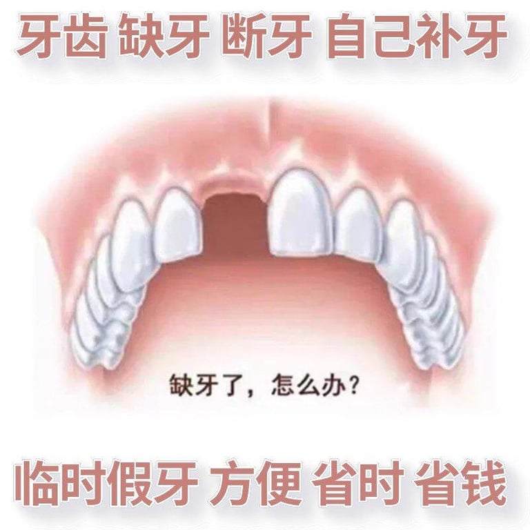 Temporary denture resin teeth missing teeth self-filling teeth front teeth filling gap dental cavity materials denture denture materials