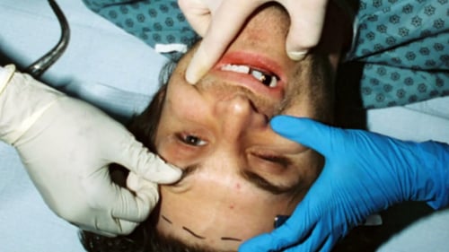 AQ - BRAIN DAMAGE  [Official Audio]