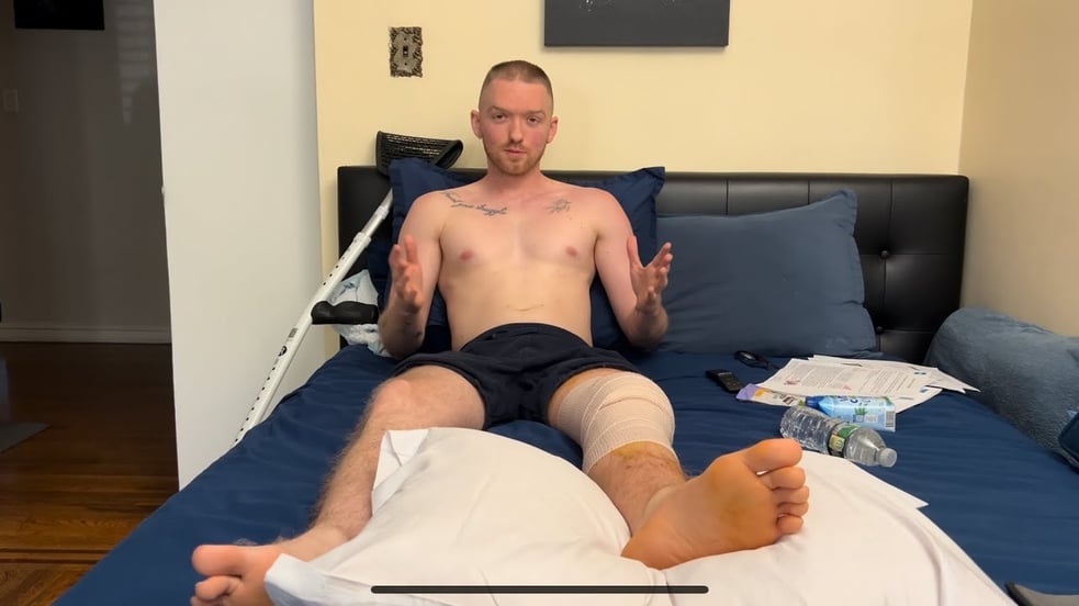 ACL Recovery - Bandage Removal + Exercises