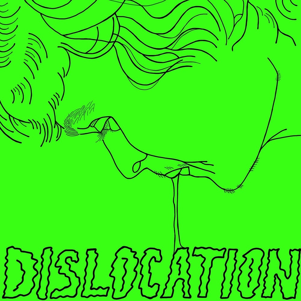 Dislocation