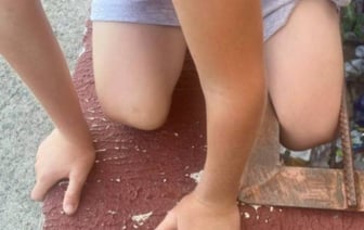 В Бресте нога ребенка застряла в решетке подвального помещения