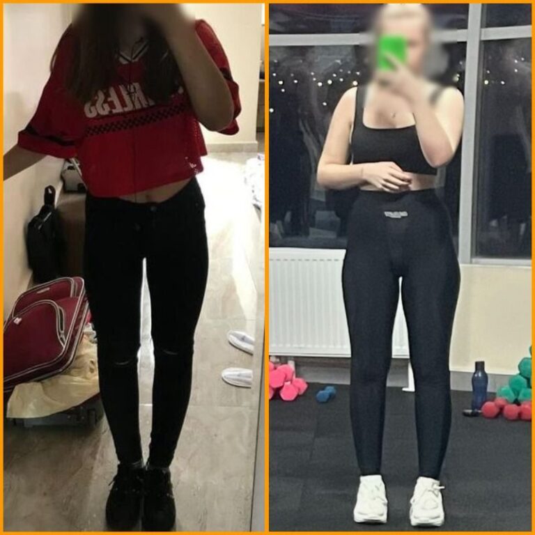 «Не чистила зубы из страха набрать калории». Шесть лет в попытках похудеть провела жительница Брестской области