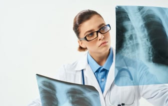 Врачи напомнили о риске смерти от рака легкого у курильщиков