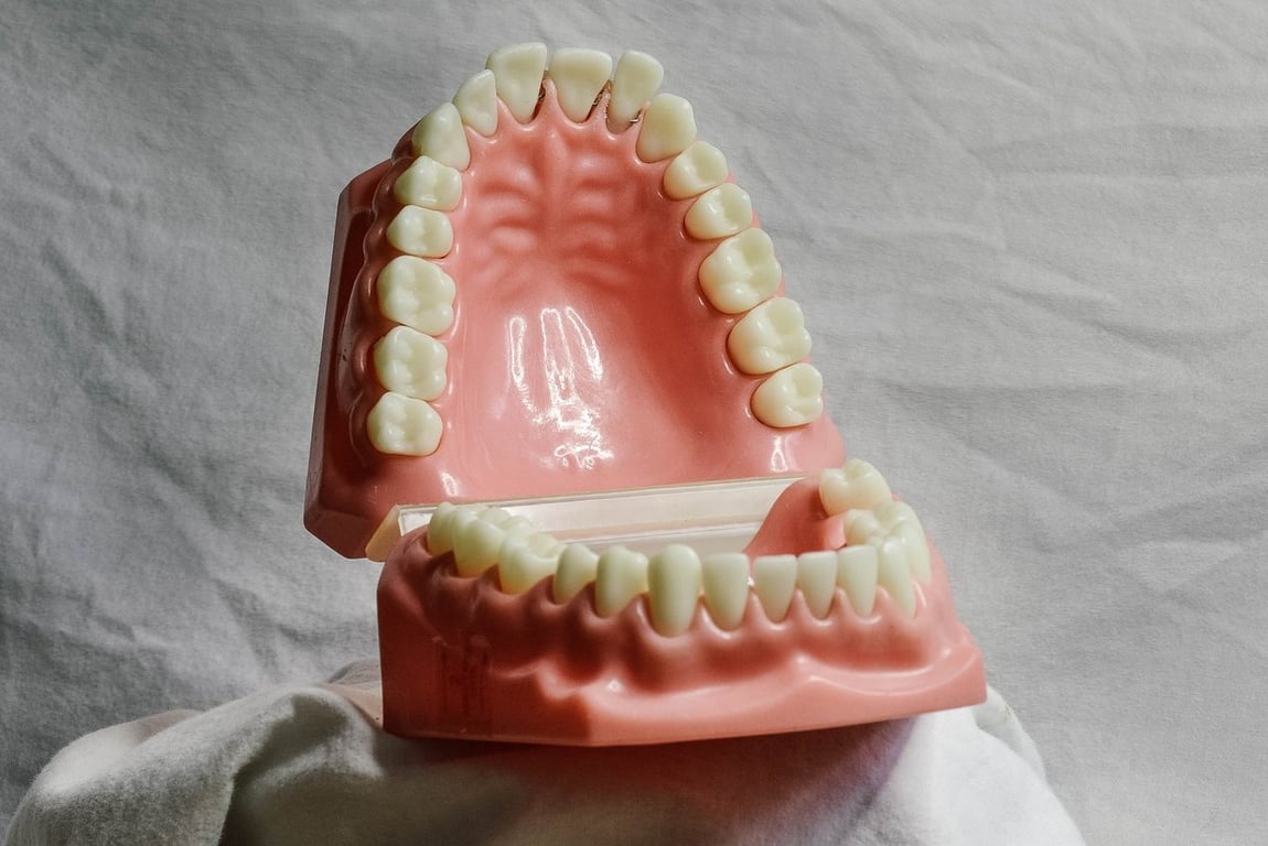 Зубы, челюсть, зубные протезы, стоматология. Фото pixabay.com