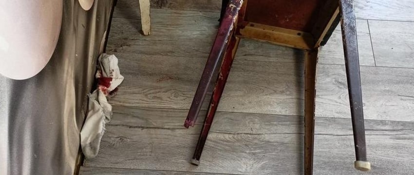 Неудачное падение на табурет привело к смерти могилевчанина