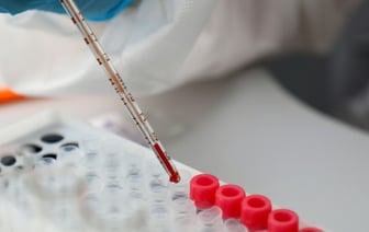 Распространение сальмонеллезной инфекции в Брестской области