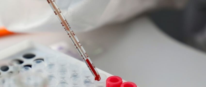 Распространение сальмонеллезной инфекции в Брестской области