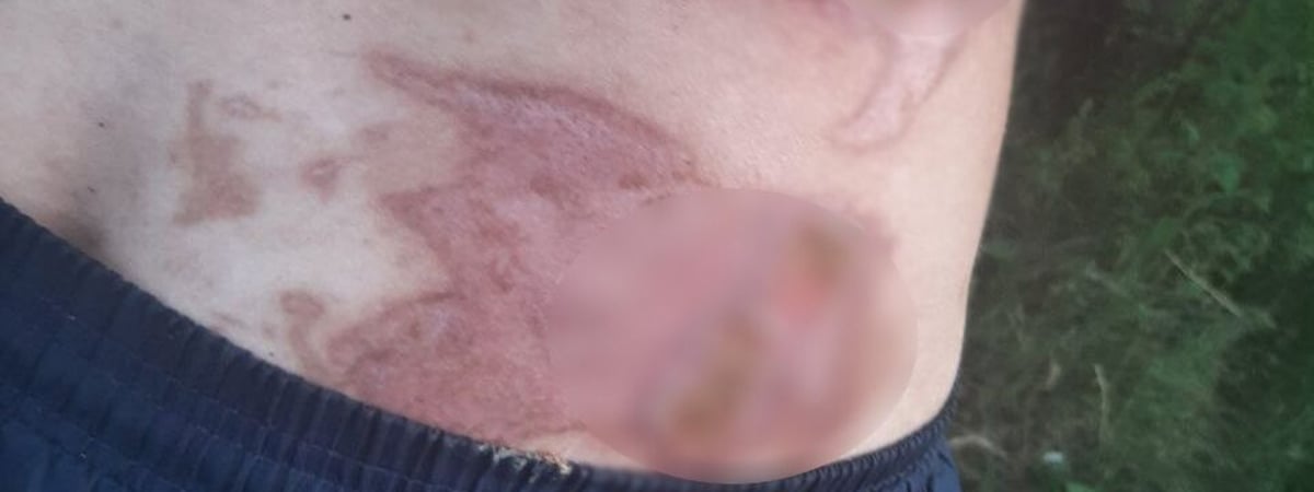 В Гродно пьяный поджег на друге майку — что было дальше