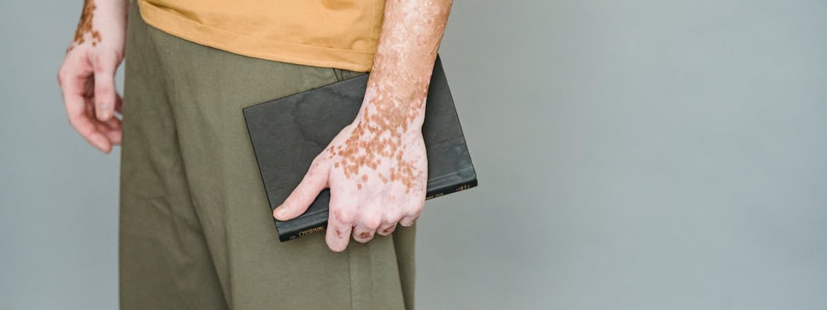 Зачем прокалывать стебли помидоров медной проволокой? Вот почему это нужно сделать в июле — Полезно