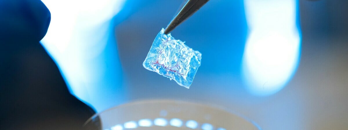 Прорыв в лечении рака: новый пластырь от рецидивов