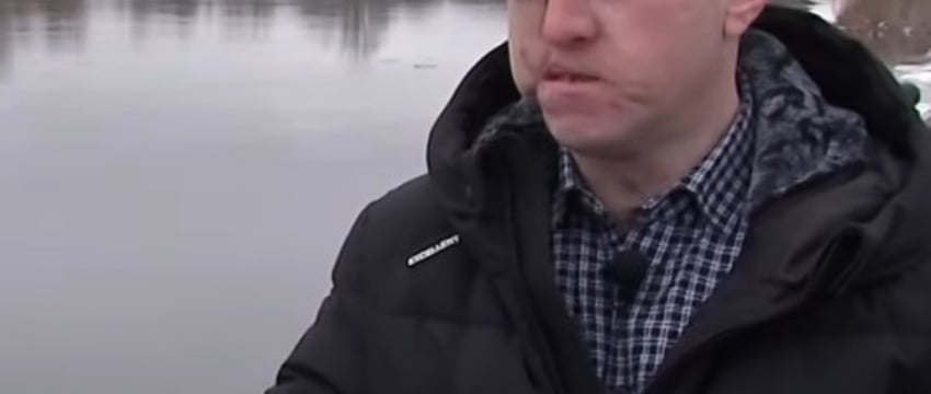 Белорусские хирурги провели уникальную операцию по пересадке лица человеку, пострадавшему в ДТП