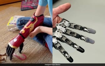 Мальчик, родившийся с одной рукой, стал самым молодым, кто получил бионическую руку героя в возрасте 5 лет.