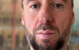 Владислав Бакальчук: против меня развязали информационную войну