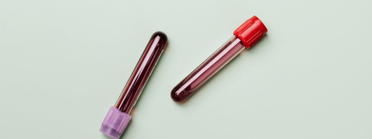 В Китае зарегистрировали вспышку метапневмовируса человека