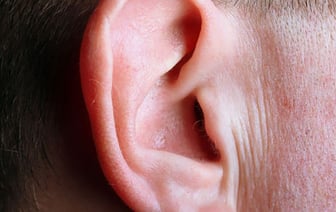 В Гомеле мужчина лишился части уха после игры в бильярд