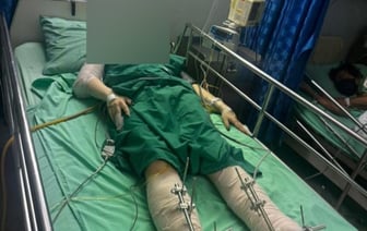 Белоруска упала с четвертого этажа отеля в Таиланде и получила тяжелые травмы — девушку транспортировали в Беларусь