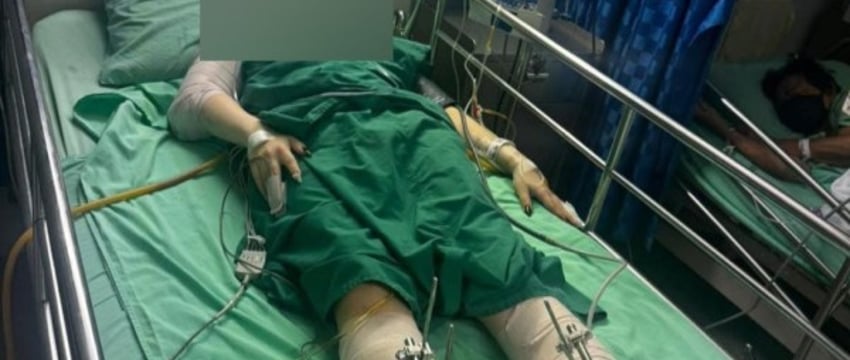 Белоруска упала с четвертого этажа отеля в Таиланде и получила тяжелые травмы — девушку транспортировали в Беларусь