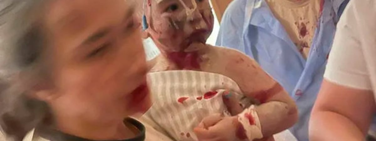 Дорофеев: «Вторая армия мира» демонстрирует свою силу, уничтожая роддома, больницы, родившихся и неродившихся детей