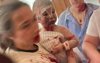 Дорофеев: «Вторая армия мира» демонстрирует свою силу, уничтожая роддома, больницы, родившихся и неродившихся детей