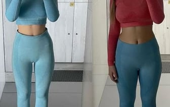 «Не чистила зубы из страха набрать калории». Шесть лет в попытках похудеть провела жительница Брестской области