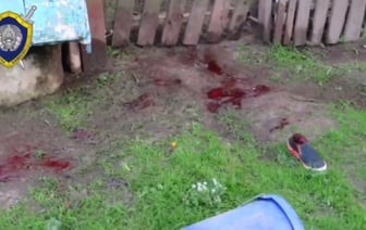 Атака собаки в Лидском районе