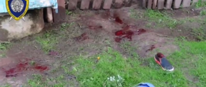 Атака собаки в Лидском районе