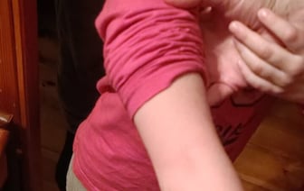 В Волковыске рука ребенка застряла в батарее — пришлось вызывать МЧС