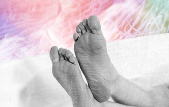 «Засовывал ногу в пакет с кефиром». Эти белорусы стыдились своих стоп — кожу и ногти «съел» грибок