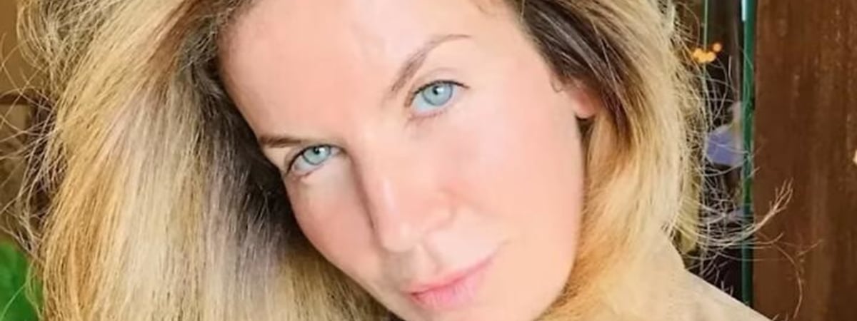 В России громкий скандал с пластическим хирургом из Беларуси: ее статусная пациентка чуть не ослепла после рядовой операции