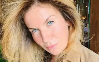 В России громкий скандал с пластическим хирургом из Беларуси: ее статусная пациентка чуть не ослепла после рядовой операции