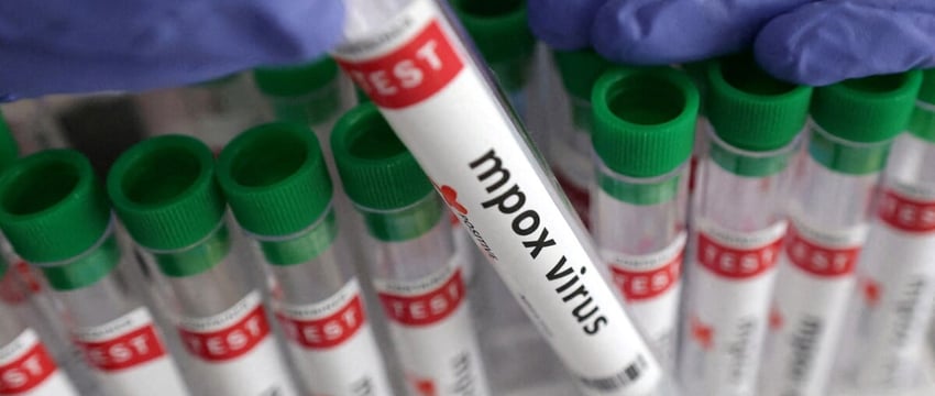 В Марокко зафиксирован первый случай оспы в Марракеше с момента объявления чрезвычайной ситуации ВОЗ.