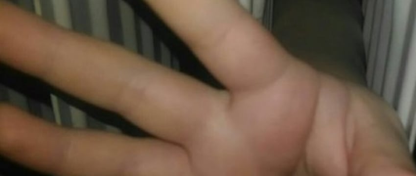 Рука брестской первоклассницы застряла в радиаторе отопления, на помощь пришли спасатели