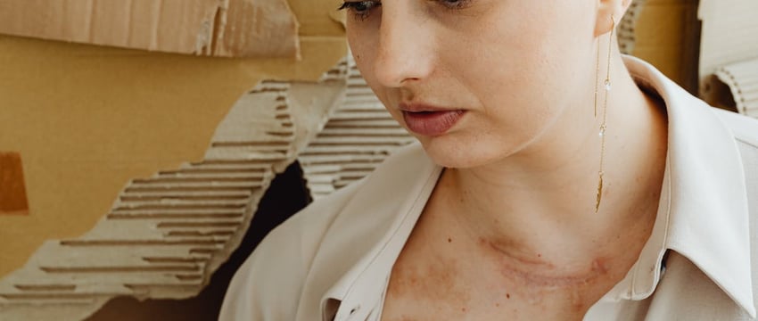 В 2023 году в Брестской области на почве семейного насилия совершено 12 убийств – УВД