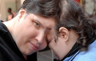 Старейшие сиамские близнецы Лори и Джордж Шаппелл скончались в США