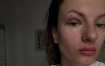 «Мне теперь приходится прятаться в квартире». Еще на одну беларуску напали в Варшаве